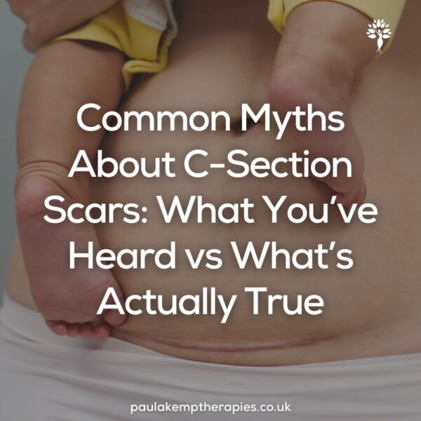 Common Myths About C-Section Scars: What You’ve Heard vs What’s Actually True