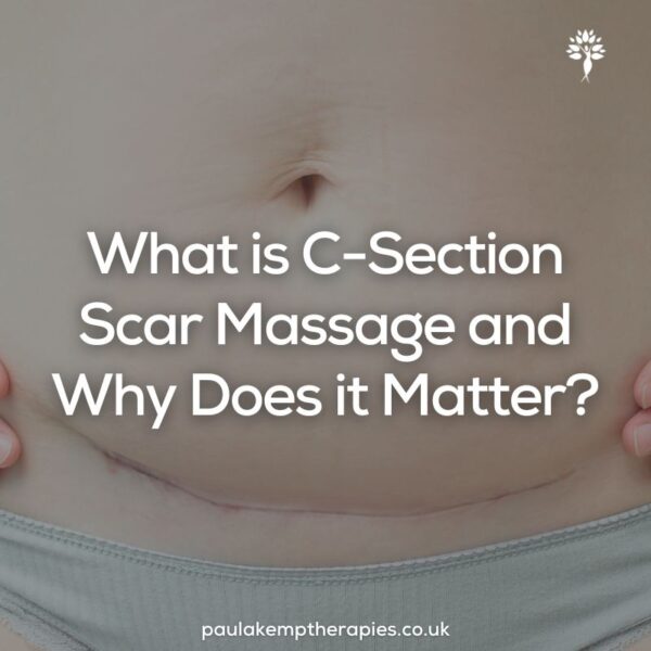What is C-Section Scar Massage and Why Does it Matter?