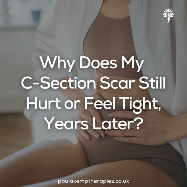 Woman sitting with her hands resting gently on her lower abdomen near her C-section scar, with the blog title "Why Does My C-Section Scar Still Hurt or Feel Tight, Years Later?" and the Paula Kemp Therapies logo.
