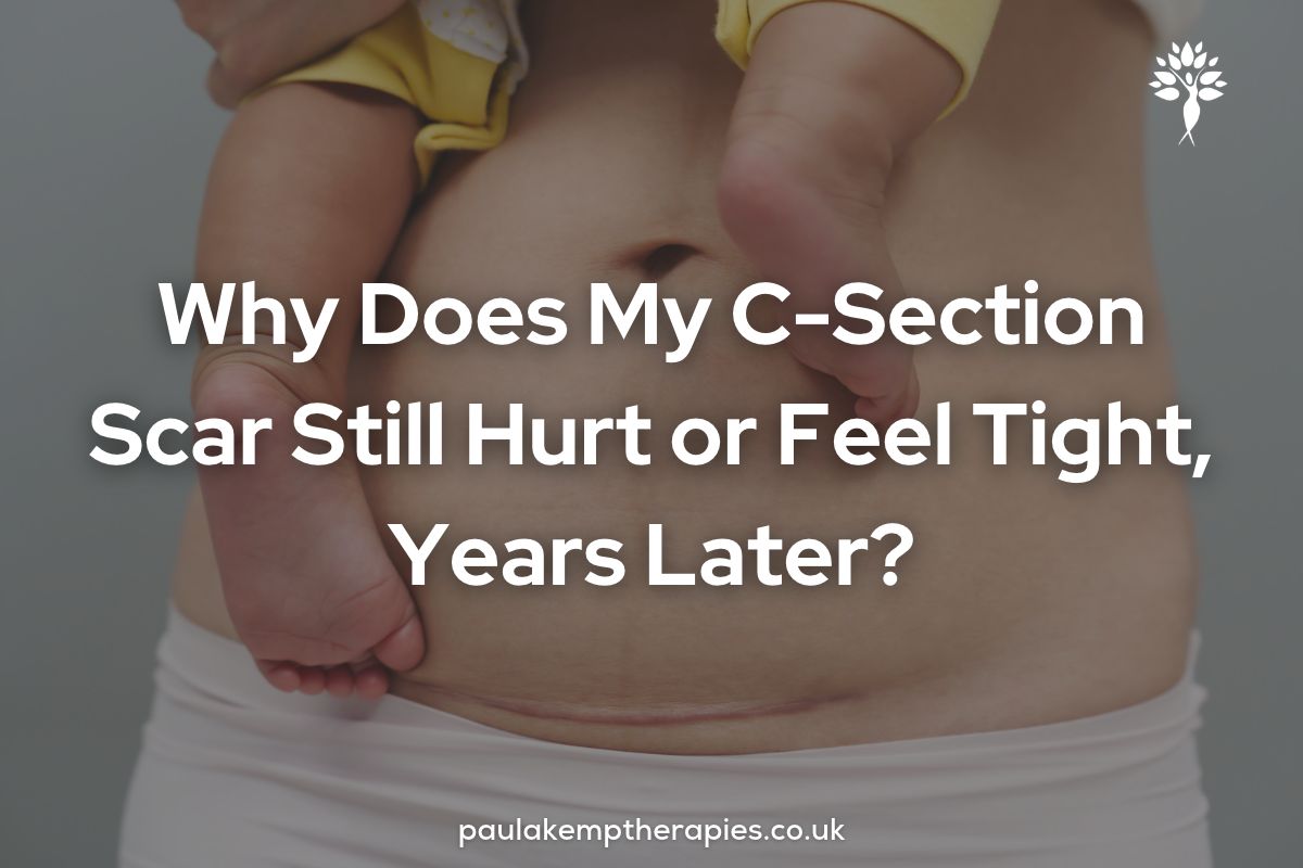 Why Does My C-Section Scar Still Hurt or Feel Tight, Years Later_ Close-up of a woman's stomach showing her healed C-section scar, with her baby's feet resting against her belly, and the blog title "Why Does My C-Section Scar Still Hurt or Feel Tight, Years Later?" with the Paula Kemp Therapies logo.