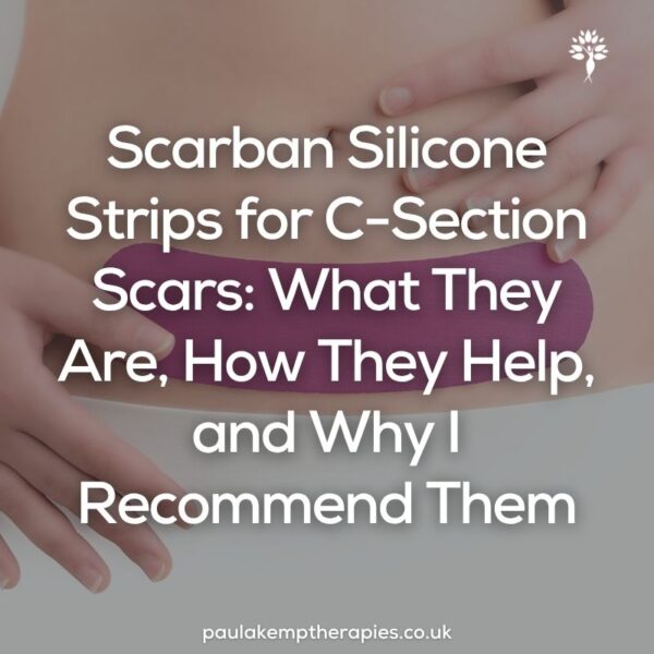 Scarban Silicone Strips for C-Section Scars: What They Are, How They Help, and Why I Recommend Them