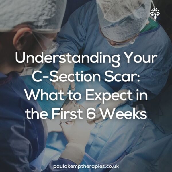 Understanding Your C-Section Scar: What to Expect in the First 6 Weeks